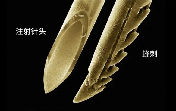 黄蜂的脑袋太可爱了吧！32张显微镜下事物的神奇照片