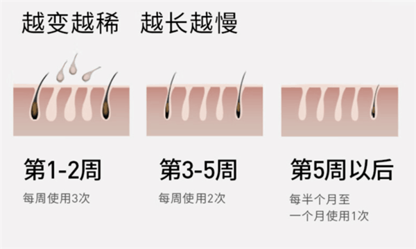 当猛男遇上脱毛仪：用前抗拒、用后真香